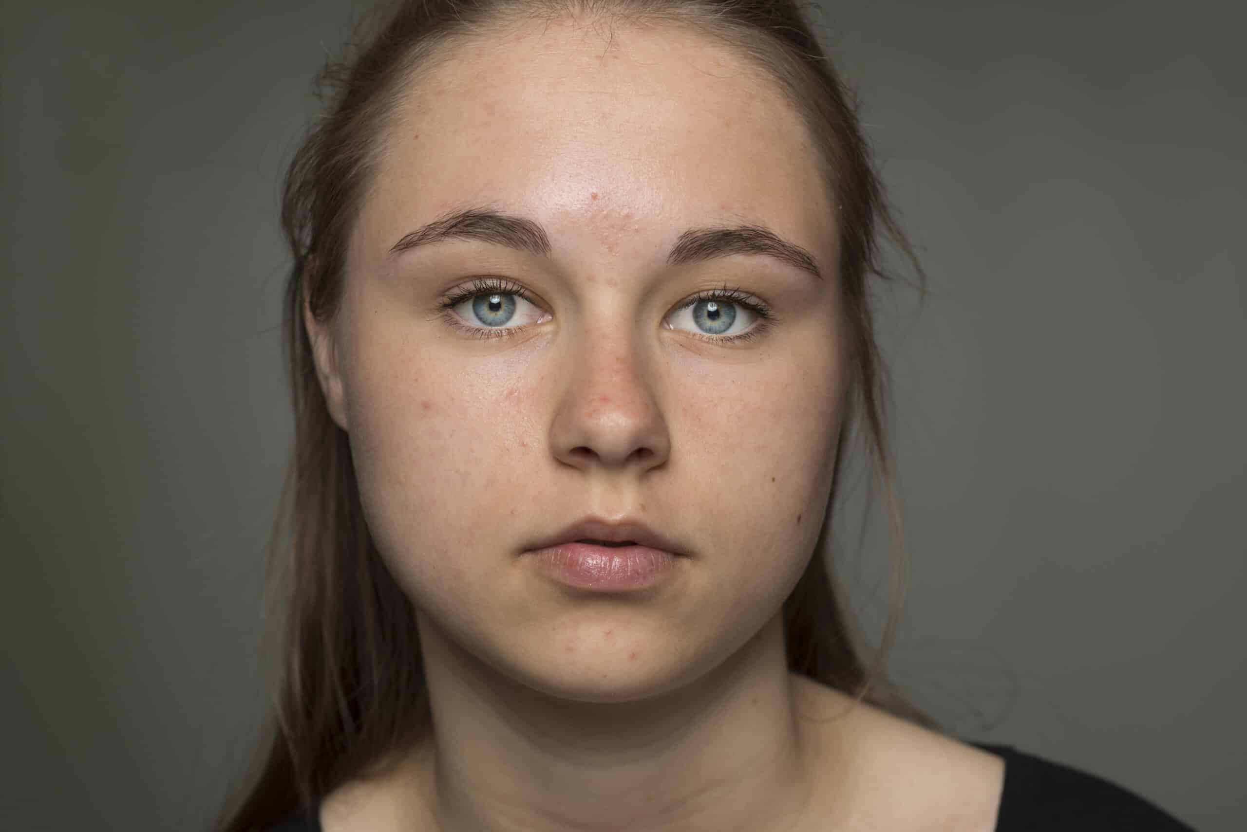 Young woman staring directly at the camera
